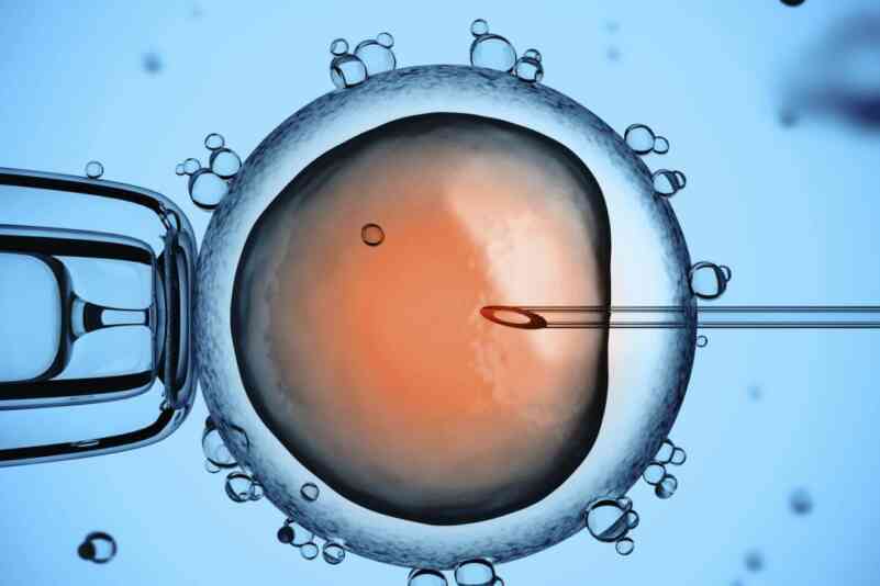 Icsi male infertility sperm 0