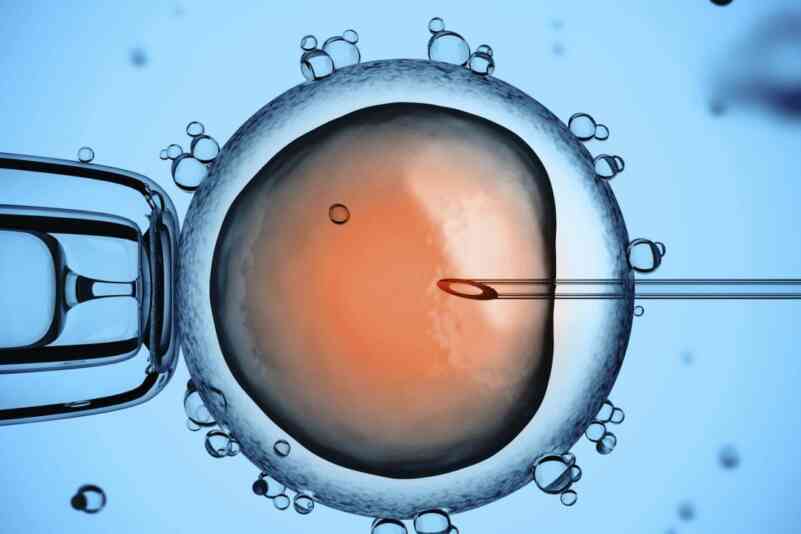 Icsi male infertility sperm